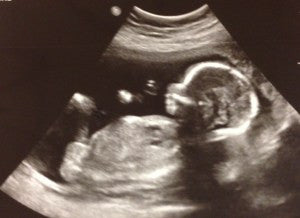 To a Next Generation Leader